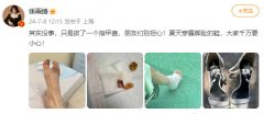 张雨绮拔了一个脚指甲 隔着屏幕都觉得疼