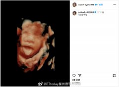 蝴蝶姐姐消失四年后突曝怀孕喜讯 蝴蝶姐姐结婚了吗老公是谁
