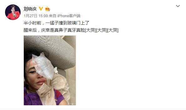 64岁刘晓庆现身脸僵到笑不动,双手出卖了年龄