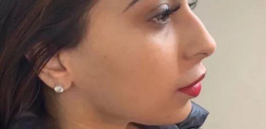 就凭敢动脸上这一点,杨天宝的美商吊打娱乐圈一半女明星