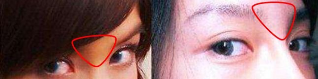 就凭敢动脸上这一点,杨天宝的美商吊打娱乐圈一半女明星