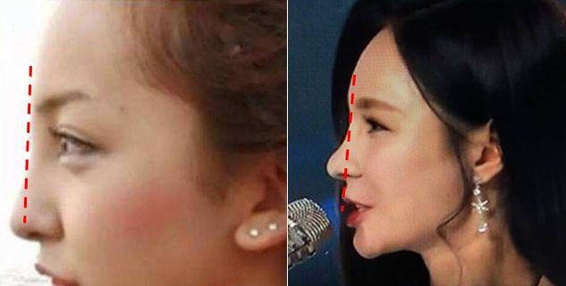 就凭敢动脸上这一点,杨天宝的美商吊打娱乐圈一半女明星