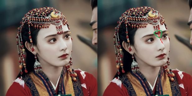 就凭敢动脸上这一点,杨天宝的美商吊打娱乐圈一半女明星