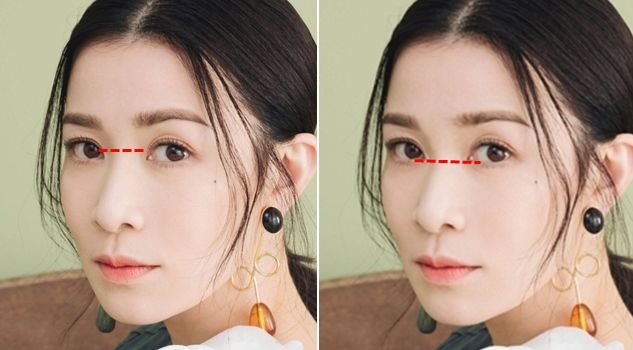 就凭敢动脸上这一点,杨天宝的美商吊打娱乐圈一半女明星