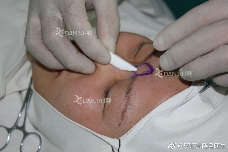 就凭敢动脸上这一点,杨天宝的美商吊打娱乐圈一半女明星