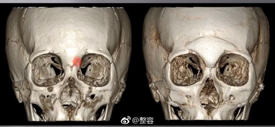 就凭敢动脸上这一点,杨天宝的美商吊打娱乐圈一半女明星