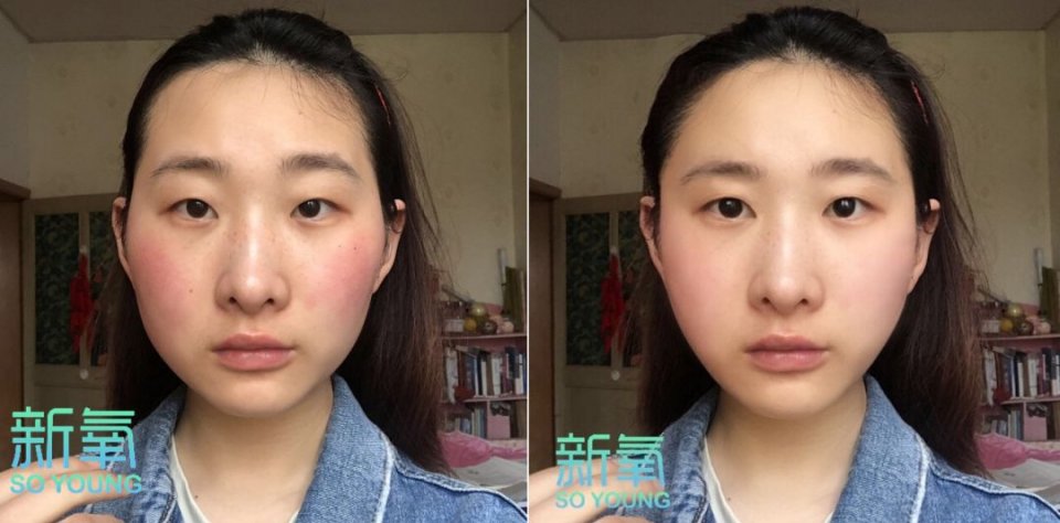 明星旧照被黑科技修复,王祖贤、刘亦菲惊艳网友,只有她整形石锤了!