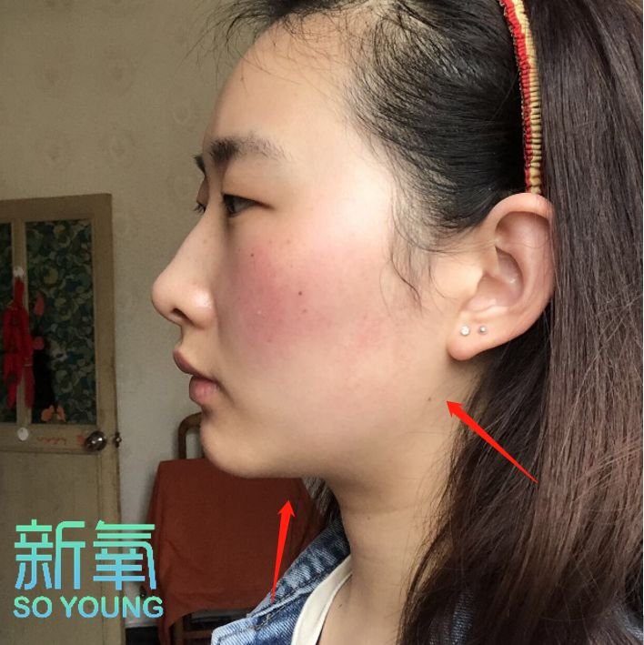 明星旧照被黑科技修复,王祖贤、刘亦菲惊艳网友,只有她整形石锤了!