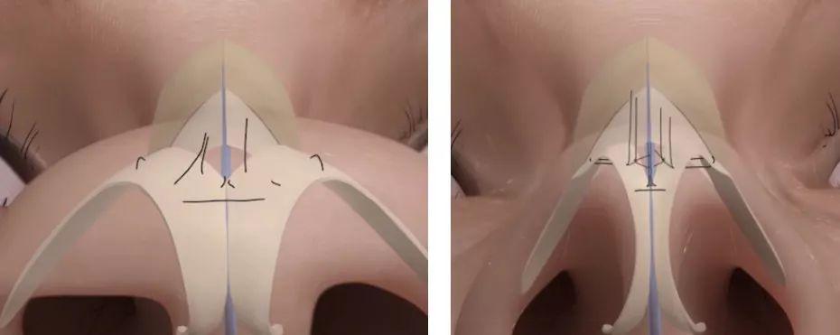 ˭˵ֻ�о��µı��Ӳźÿ������ı��Ӵ�������Ҳ�ܹ������¸߶�