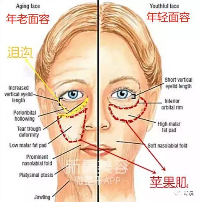 120斤的刘涛为减肥直播喝不明红色液体?而90斤的张雪迎脚踝比脖子粗...