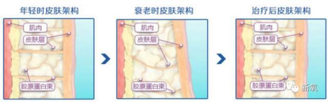 120斤的刘涛为减肥直播喝不明红色液体?而90斤的张雪迎脚踝比脖子粗...