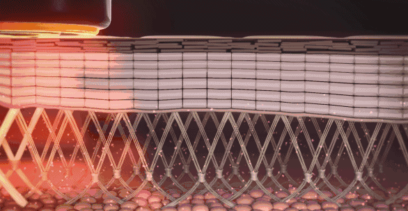 120斤的刘涛为减肥直播喝不明红色液体?而90斤的张雪迎脚踝比脖子粗...