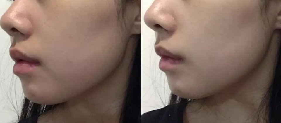 120斤的刘涛为减肥直播喝不明红色液体?而90斤的张雪迎脚踝比脖子粗...