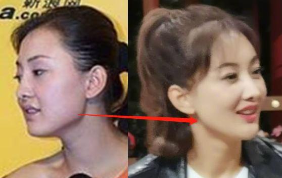 46ꡰϱרҵŭ20Ⱦݵڶ