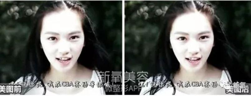 关晓彤全身擦粉实锤了!高清镜头下耳朵后面黑成这样···