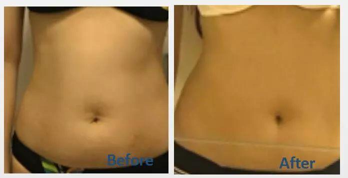 ��125��89��, ������ɵ�Ů�˶����