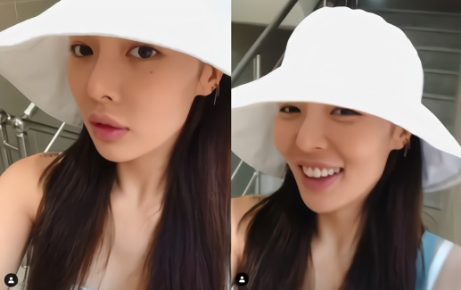 泫雅再晒素颜嘴唇被指肿胀 网友:原本的样子比较好看