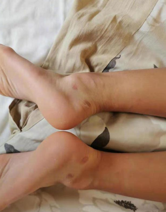 ɭ����������˫����Ѫ�� ���ϸ��ס�����ɹ����������ο